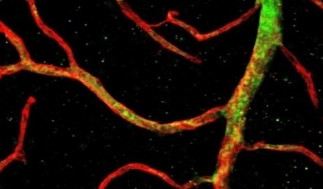 Desarrollan la primera tecnología endovascular que puede explorar capilares