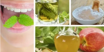 Los 9 mejores remedios caseros para aliviar el mal aliento o halitosis