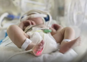 Por qué mueren 10 veces más bebés por covid-19 en Brasil que en Estados Unidos