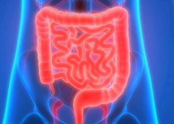 El 80 % de pacientes con enfermedad celíaca no sabe que la padece