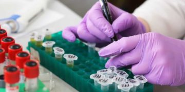 Deportes activa las alarmas para evitar la sanción de la WADA